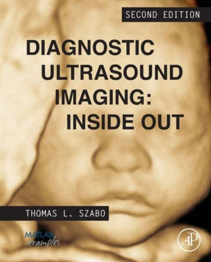 Diagnostic Ultrasound Imaging: Inside Out av Thomas L. (Research Professor Department of Biomedical Engineering Boston University MA USA) Szabo