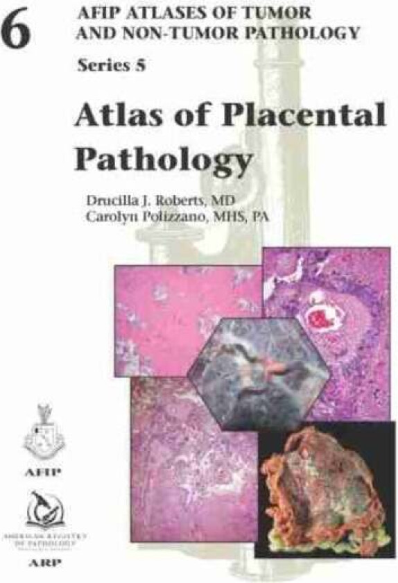 Atlas of Placental Pathology av Drucilla J. Roberts, Carolyn Polizzano