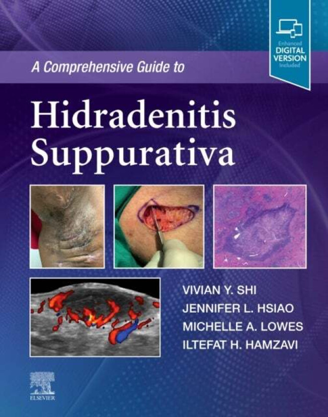 A Comprehensive Guide to Hidradenitis Suppurativa av Vivian Y. MD (Associate Professor Department of Dermatology University of Arkansas for Medical Sc