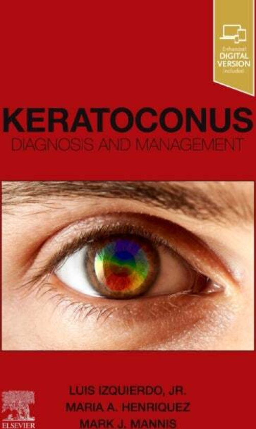 Keratoconus
