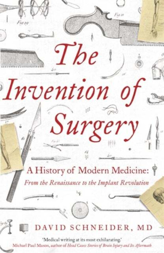 The Invention of Surgery av David Schneider