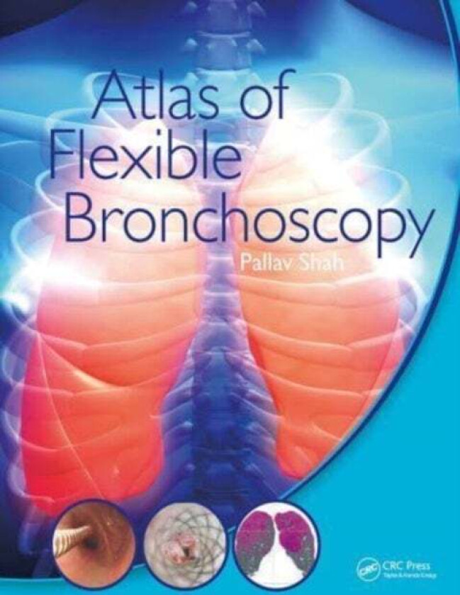 Atlas of Flexible Bronchoscopy av Pallav (MD MBBS FRCP Consultant Physician Royal Brompton Hospital and Chelsea and Westminster Hospital London UK) Sh