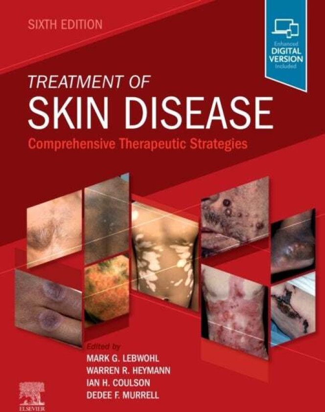 Treatment of Skin Disease av Mark Lebwohl, Ian H. BSc MB FRCP Coulson, Mur
