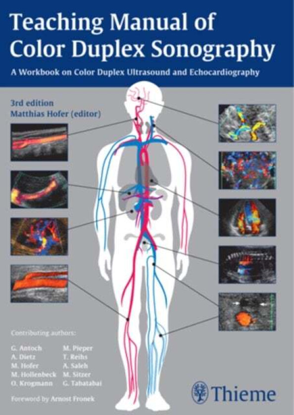 Teaching Manual of Color Duplex Sonography av Matthias Hofer, MEDIDAK Publishing GmbH