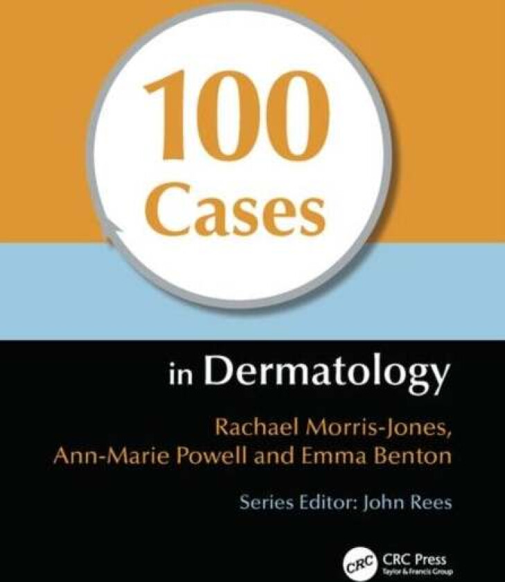 100 Cases in Dermatology av Rachael Morris-Jones, Ann-Marie Powell, Emma Benton