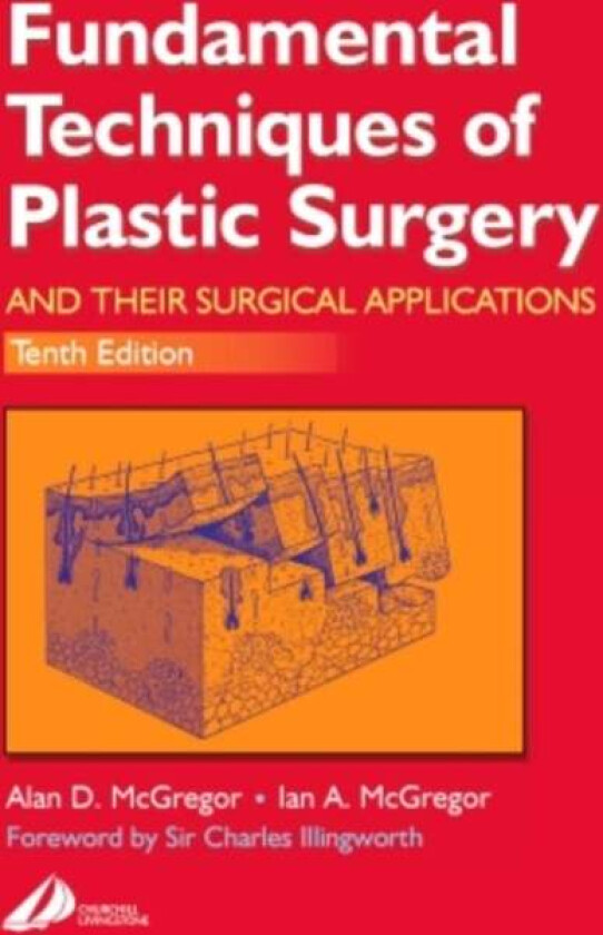 Fundamental Techniques of Plastic Surgery av Alan D. McGregor, Ian A. McGregor