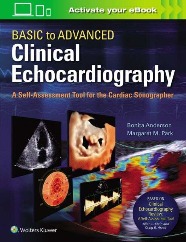 Basic to Advanced Clinical Echocardiography av Bonita Anderson, Margaret M. Park