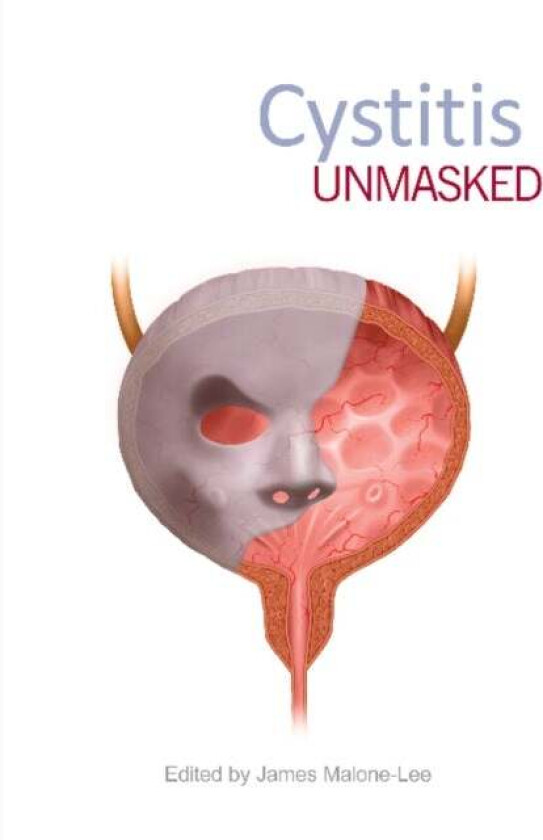 Cystitis Unmasked