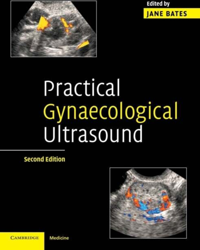 Practical Gynaecological Ultrasound