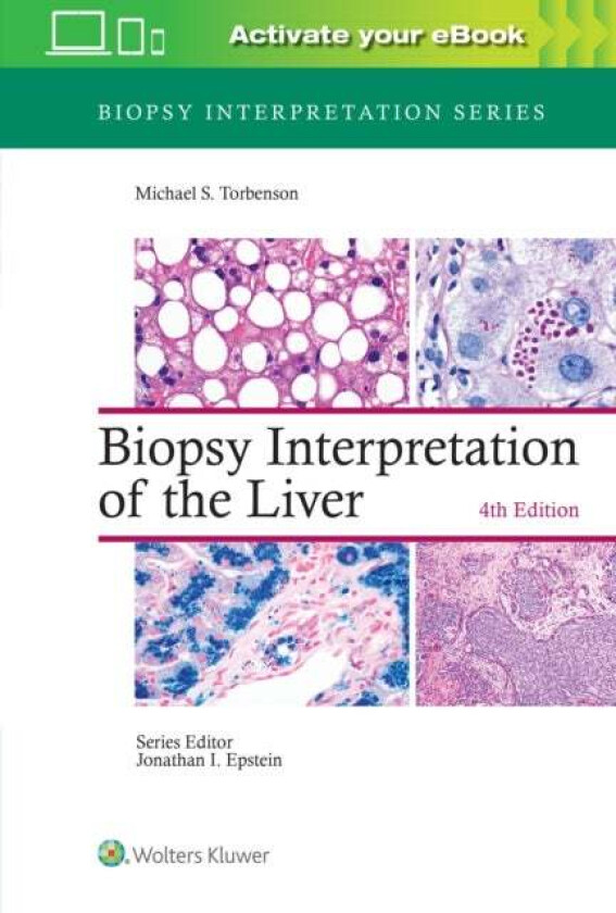 Biopsy Interpretation of the Liver av Michael MD Torbenson