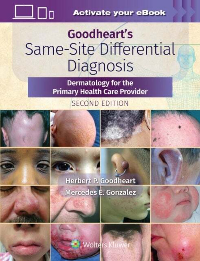 Goodheart's Same-Site Differential Diagnosis av Herbert Goodheart