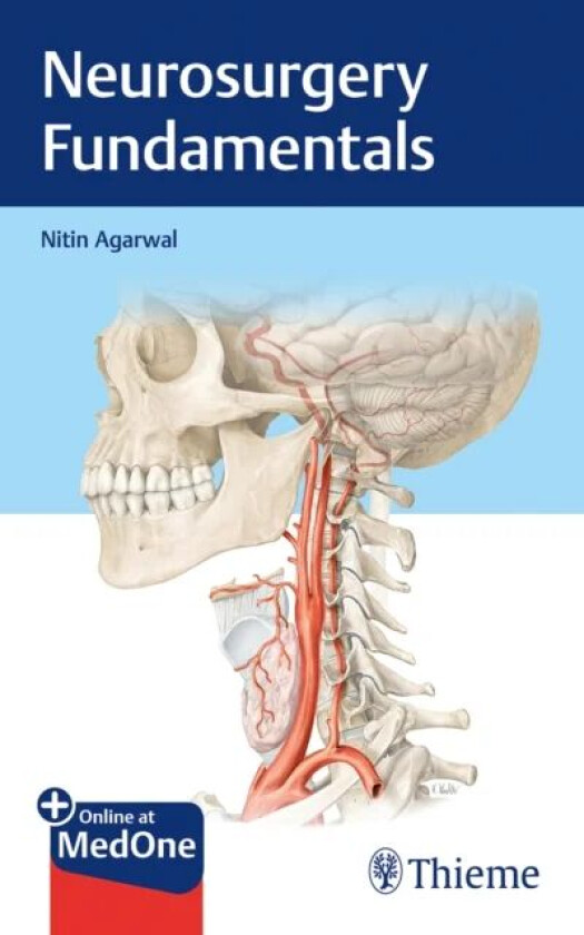 Neurosurgery Fundamentals av Nitin Agarwal
