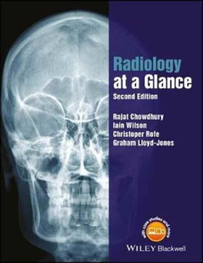 Radiology at a Glance av Rajat (Southampton General Hospital) Chowdhury, Iain (Southampton General Hospital) Wilson, Christopher (Southampton General