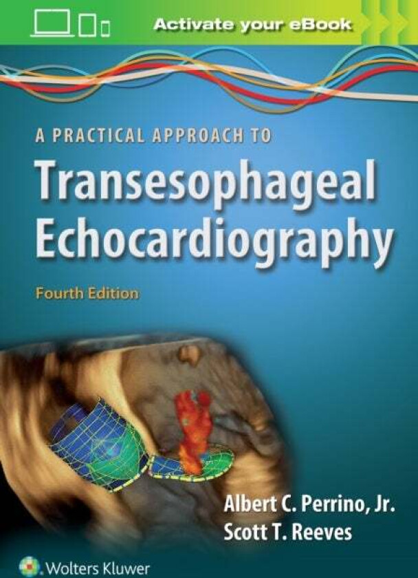 A Practical Approach to Transesophageal Echocardiography av Albert C. Perrino, Scott T. Reeves