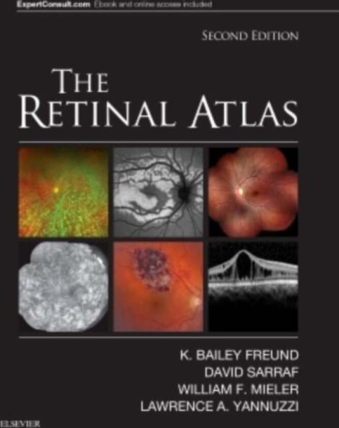 The Retinal Atlas av K. Bailey (Clinical Professor of Ophthalmology New York University School of Medicine Freund, New York City NY) Vitreous Retina M