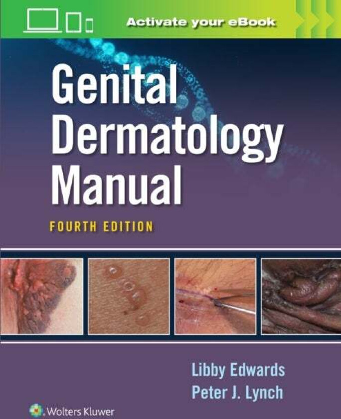 Genital Dermatology Manual av Elizabeth Edwards, Dr. Peter Lynch