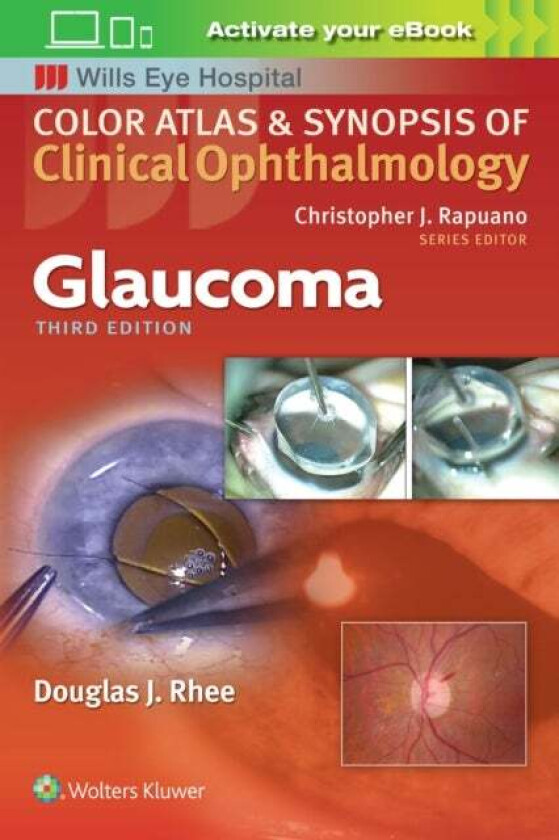 Glaucoma av Douglas Rhee