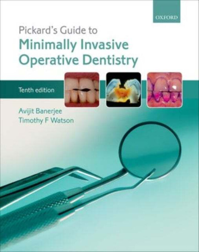 Pickard's Guide to Minimally Invasive Operative Dentistry av Avijit (Professor of Cariology & Operative Dentistry Professor of Cariology &