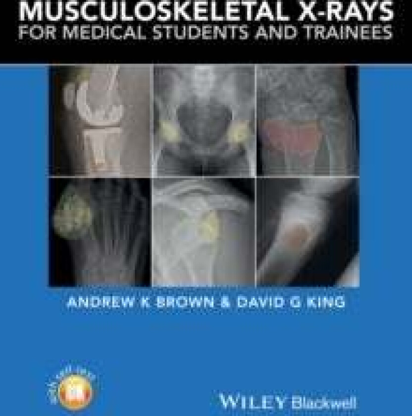 Musculoskeletal X-Rays for Medical Students and Trainees av Andrew (Consultant Rheumatologist and Senior Lecturer in Medical Education Hull York Medic