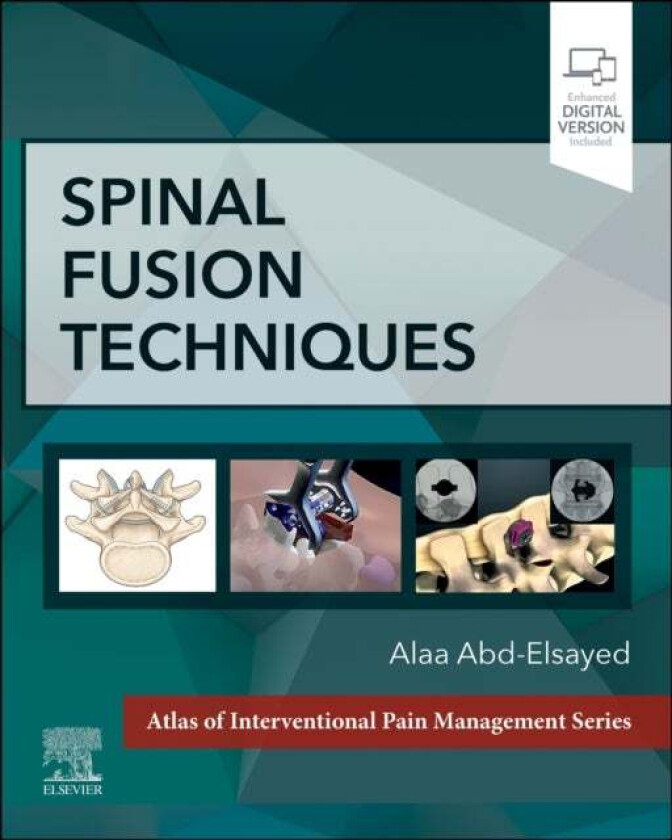 Spinal Fusion Techniques av Alaa MD MPH FASA (Medical Director UW Pain Clinic Division Chief Chronic Pain Medicine University of Wisconsin-Madison Mad