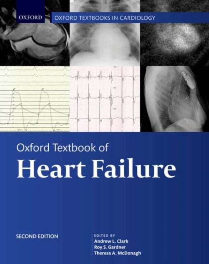 Bilde av Oxford Textbook of Heart Failure