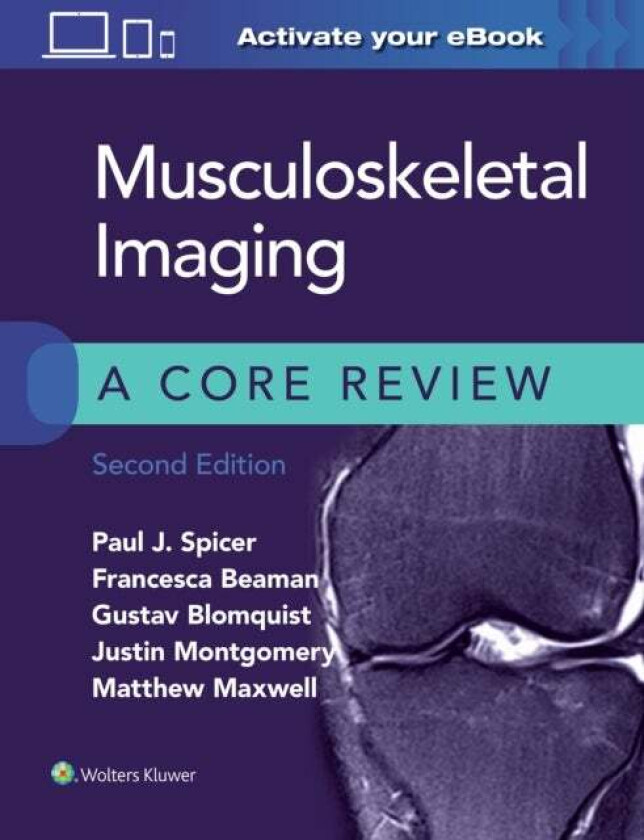Musculoskeletal Imaging: A Core Review av Paul Spicer, Francesca Beaman, Gustav Blomquist, Justin Montgomery, Matthew Maxwell