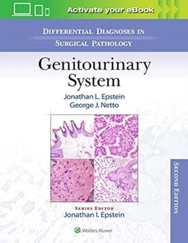 Differential Diagnoses in Surgical Pathology: Genitourinary System av Jonathan Epstein, George J. Netto