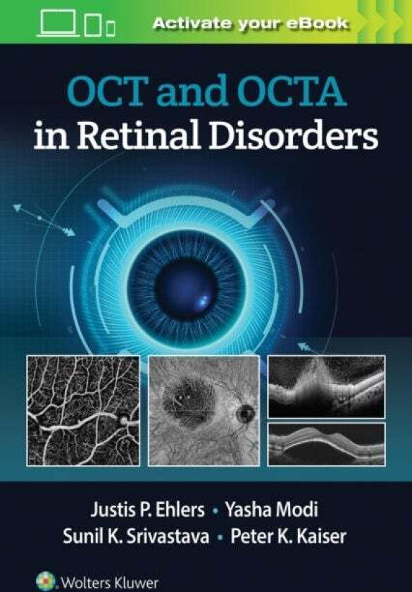 OCT and OCTA in Retinal Disorders av Justis P. Ehlers