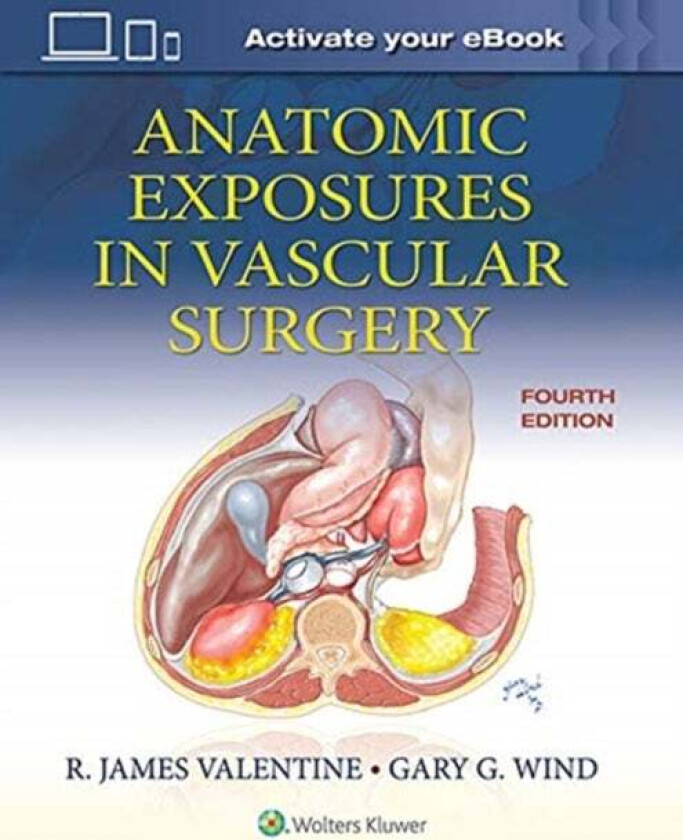 Anatomic Exposures in Vascular Surgery av R. James Valentine, Gary G. Wind