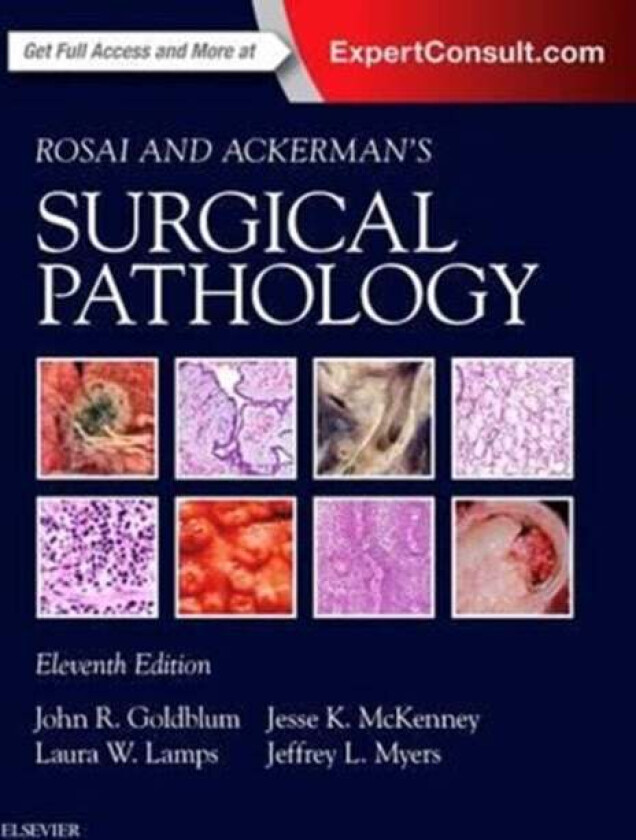 Bilde av Rosai and Ackerman's Surgical Pathology - 2 Volume Set av John R. MD FCAP FASCP FACG (Chairman of Pathology Cleveland Clinic Goldblum, Cleveland