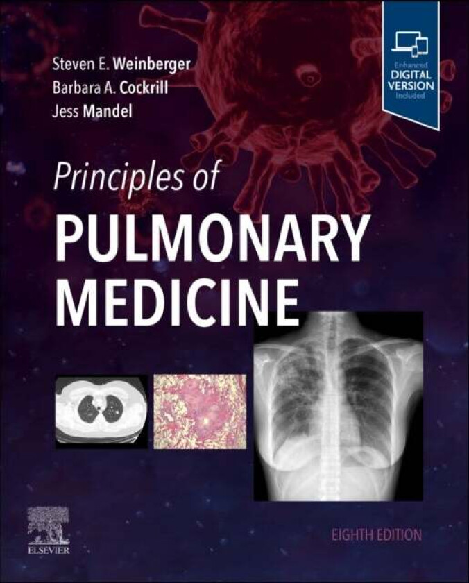 Principles of Pulmonary Medicine av Steven E. (Executive Vice President and Chief Executive Officer American College of Physicians Weinberger, Perelma
