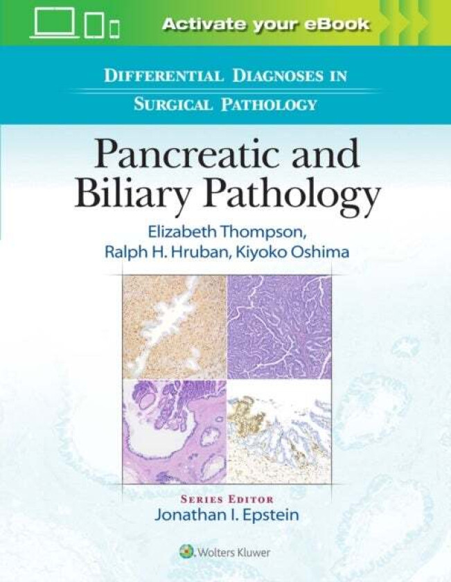 Differential Diagnoses in Surgical Pathology: Pancreatic and Biliary Pathology av Elizabeth Dell MD PhD Thompson, Ralph H. Hruban, Kiyoko Oshima