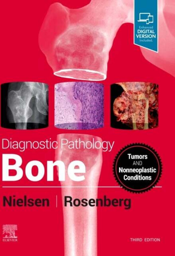 Diagnostic Pathology: Bone av G. Petur (Pathologist Massachusetts General Hospital Professor of Pathology Harvard Medical School Boston MA) Nielsen, A