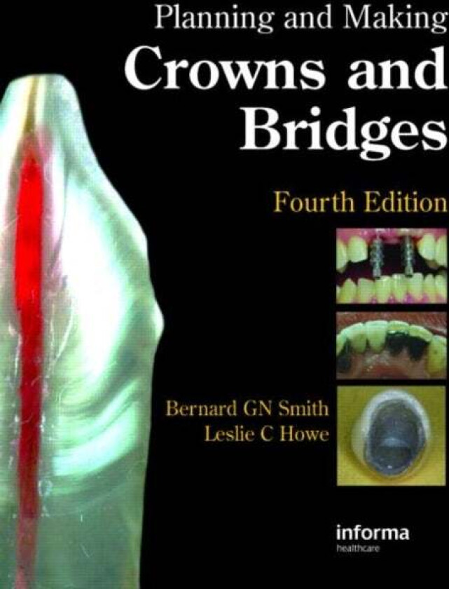 Bilde av Planning and Making Crowns and Bridges av Bernard G. N. (Formerly Guy's Hospital London UK) Smith, Leslie C. Howe