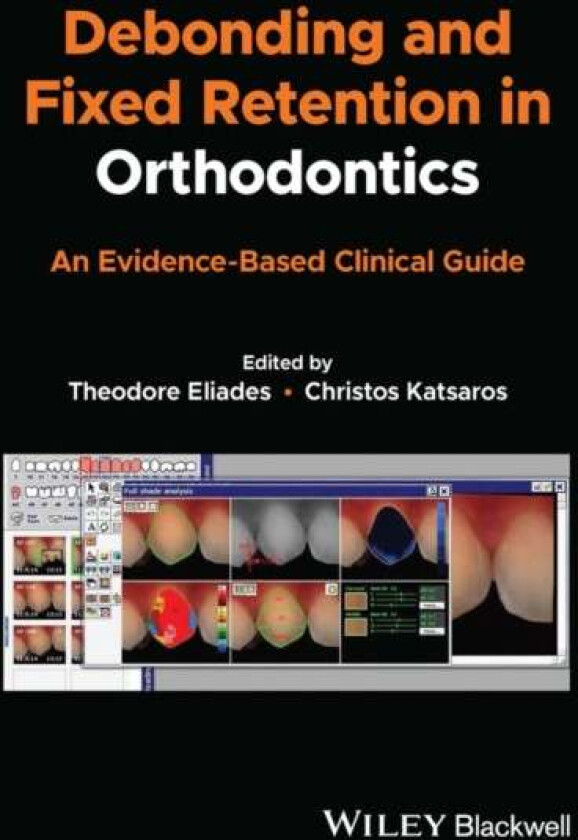 Debonding and Fixed Retention in Orthodontics