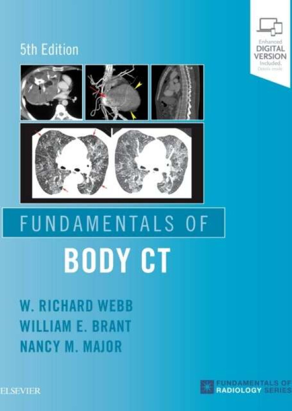 Fundamentals of Body CT av W Richard MD (Professor Emeritus of Radiology and Biomedical Imaging Emeritus Member Haile Debas Academy of Medical Educato