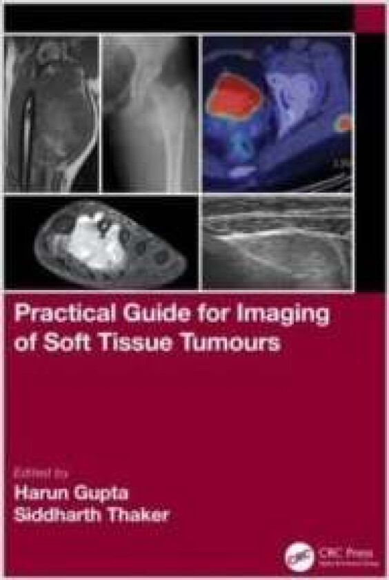 Practical Guide for Imaging of Soft Tissue Tumours