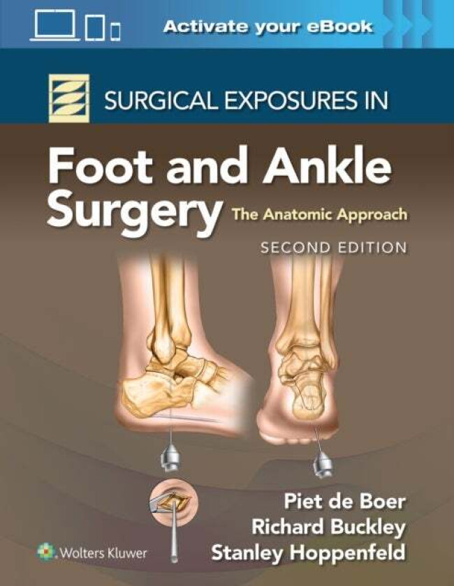 Surgical Exposures in Foot and Ankle Surgery: The Anatomic Approach av Dr. Richard MD Buckley