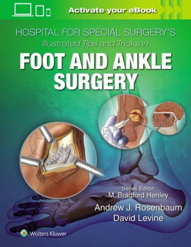 Hospital for Special Surgery's Illustrated Tips and Tricks in Foot and Ankle Surgery av David Levine