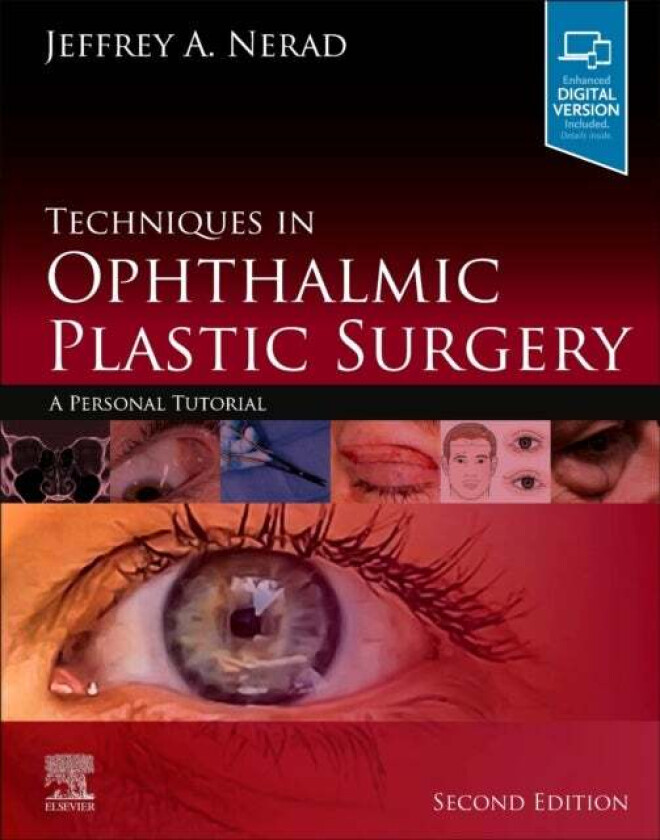 Techniques in Ophthalmic Plastic Surgery av Jeffrey A. (Partner Cincinnati Eye Institute Nerad, University of Cincinnati Cincinnati Ohio) Professor of