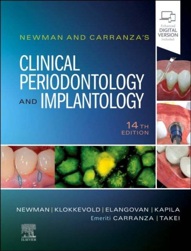 Newman and Carranza's Clinical Periodontology and Implantology av Michael G. (Professor Emeritus Section of Periodontics School of Dentistry Univ