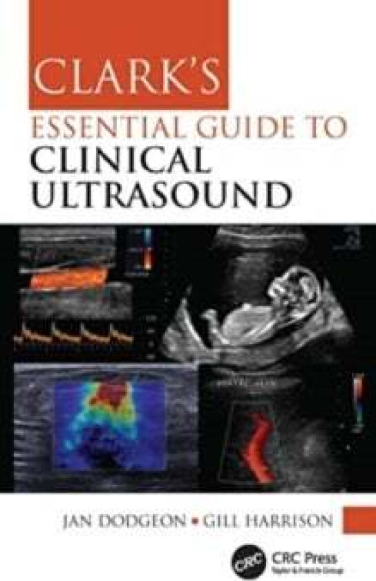 Clark's Essential Guide to Clinical Ultrasound av Jan Dodgeon, Gill Harrison