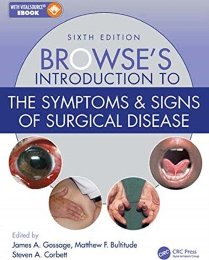 Browse's Introduction to the Symptoms & Signs of Surgical Disease