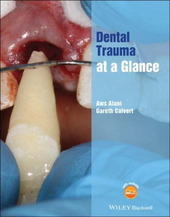 Dental Trauma at a Glance av Aws Alani, Gareth Calvert