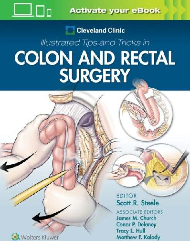Cleveland Clinic Illustrated Tips and Tricks in Colon and Rectal Surgery av Scott Steele