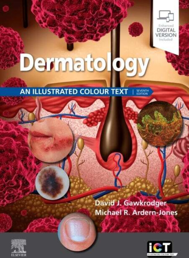 Dermatology av David Gawkrodger, Michael R BSc M Ardern-Jones