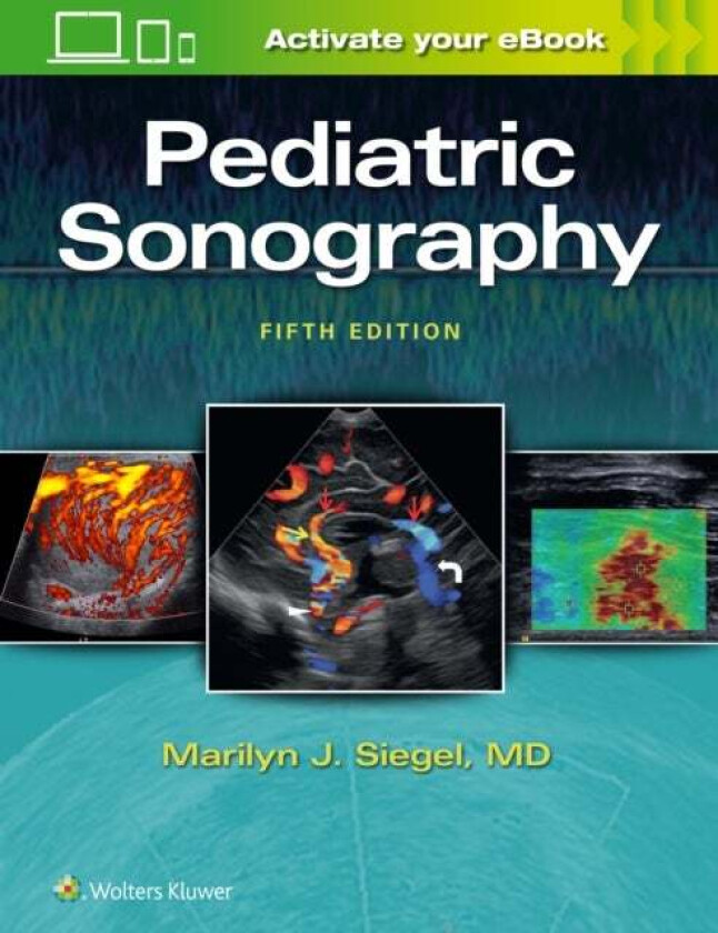 Pediatric Sonography av Marilyn J. Siegel