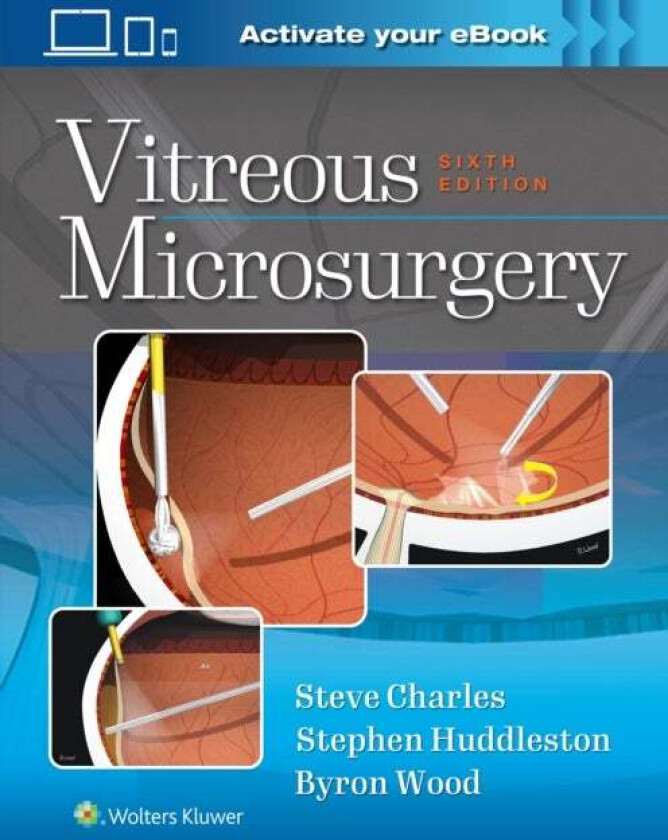 Vitreous Microsurgery av Steve Charles