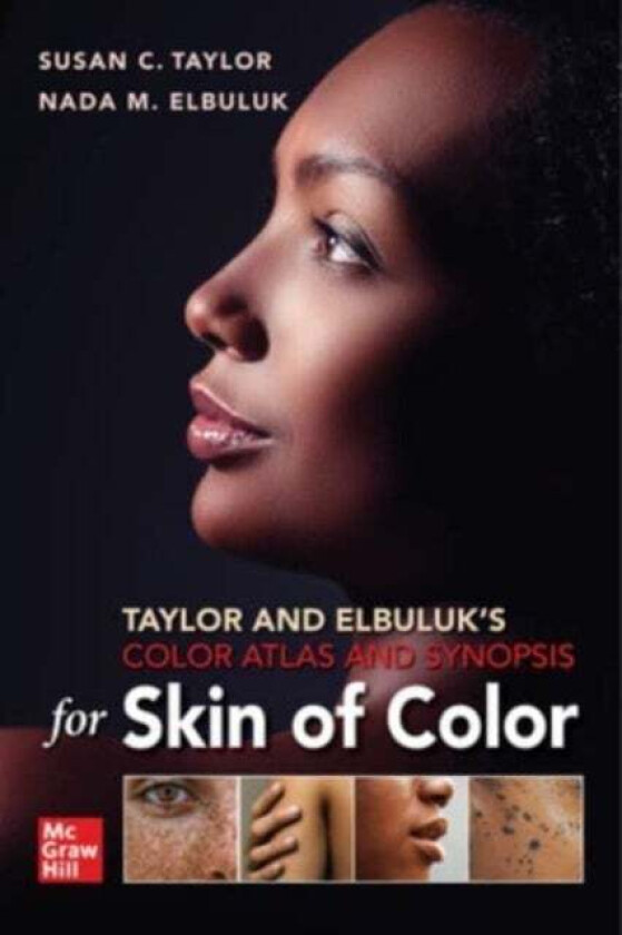 Taylor and Elbuluk's Color Atlas and Synopsis for Skin of Color av Susan Taylor, Nada Elbuluk