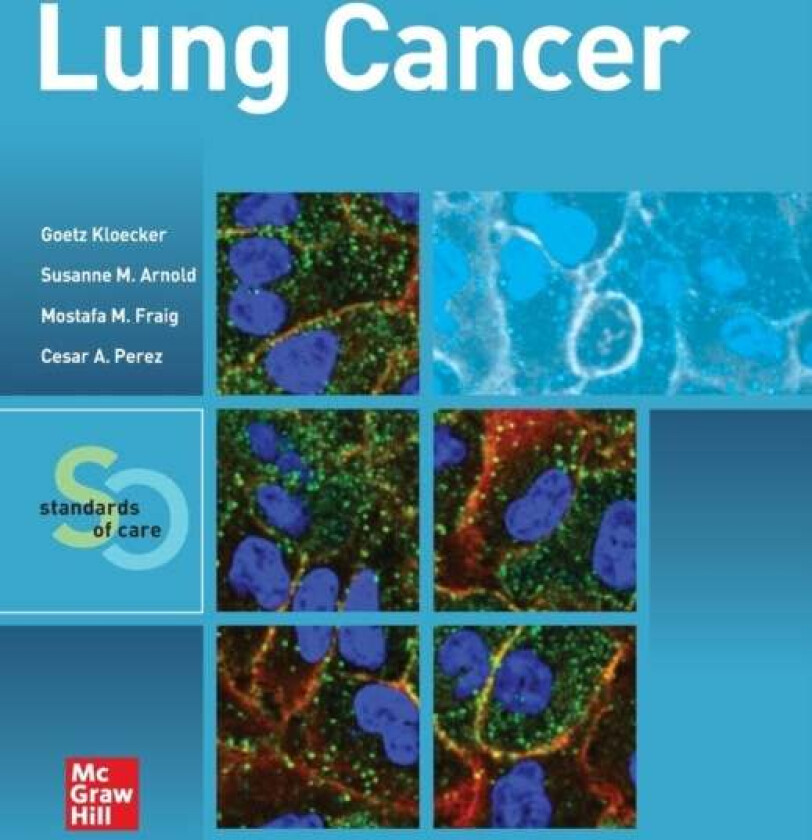 Lung Cancer: Standards of Care av Goetz Kloecker, Mostafa Fraig, Susanne M. Arnold, Cesar A. Perez
